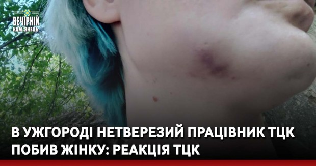 В Ужгороді нетверезий працівник ТЦК побив жінку: реакція ТЦК