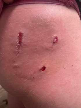 У Кам'янці-Подільському безпритульні собаки покусали дитину: матір просить про допомогу