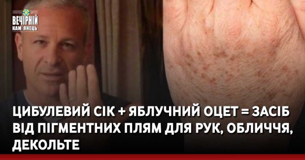 Цибулевий сік + яблучний оцет = Засіб від пігментних плям для рук, обличчя, декольте