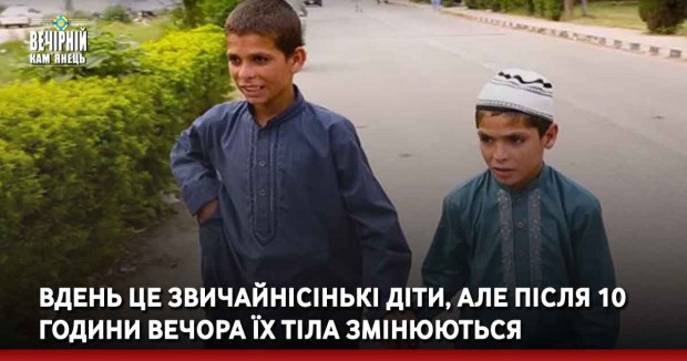  Вдень це звичайнісінькі діти, але після 10 години вечора їх тіла змінюються