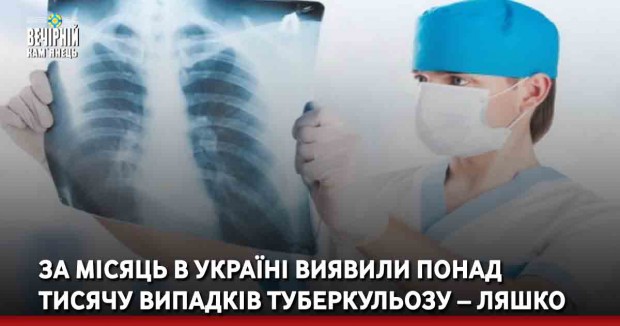 За місяць в Україні виявили понад тисячу випадків туберкульозу – Ляшко