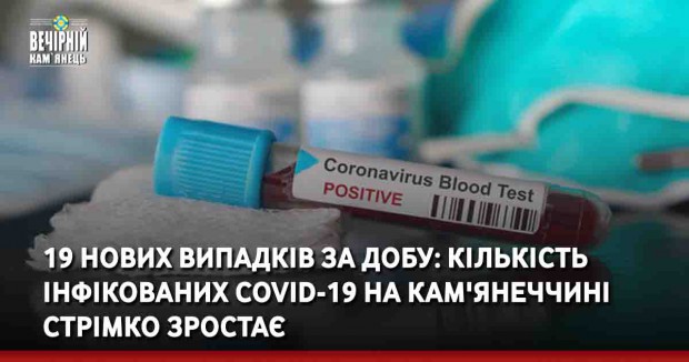 19 нових випадків за добу: кількість інфікованих COVID-19 на Кам'янеччині стрімко зростає