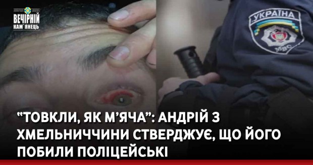 “Товкли, як м’яча”: Андрій з Хмельниччини стверджує, що його побили поліцейські