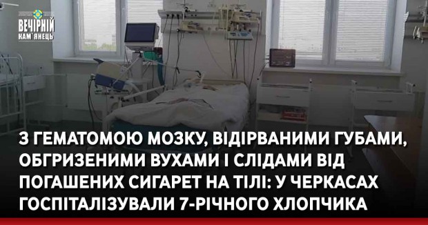 З гематомою мозку, відірваними губами, обгризеними вухами і слідами від погашених сигарет на тілі: у Черкасах госпіталізували 7-річного хлопчика