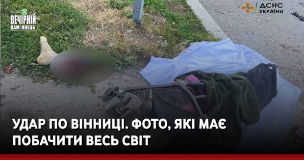 Удар по Вінниці. Фото, які має побачити весь світ