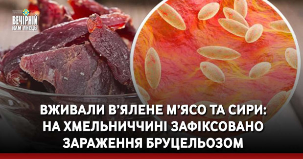 Вживали в’ялене м’ясо та сири: на Хмельниччині зафіксовано зараження бруцельозом