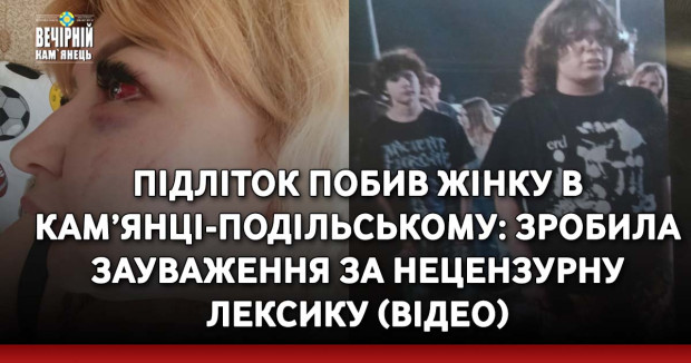 Підліток побив жінку в Кам’янці-Подільському: зробила зауваження за нецензурну лексику (ВІДЕО)