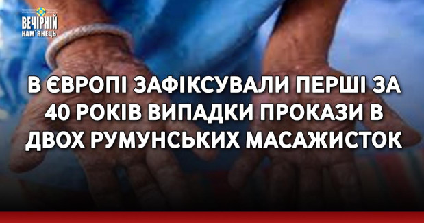 В Європі зафіксували перші за 40 років випадки прокази в двох румунських масажисток