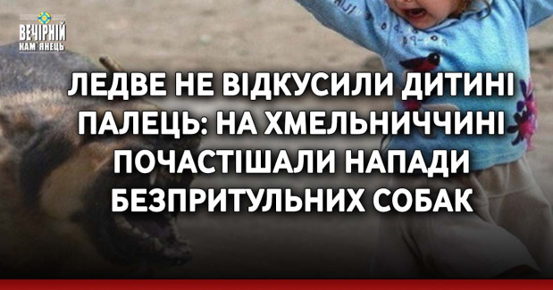 Ледве не відкусили дитині палець: на Хмельниччині почастішали напади безпритульних собак