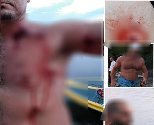 дністер 5 серпня стрілянина