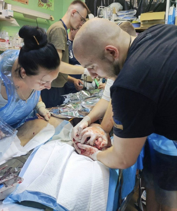 евакуйований з ампутацією